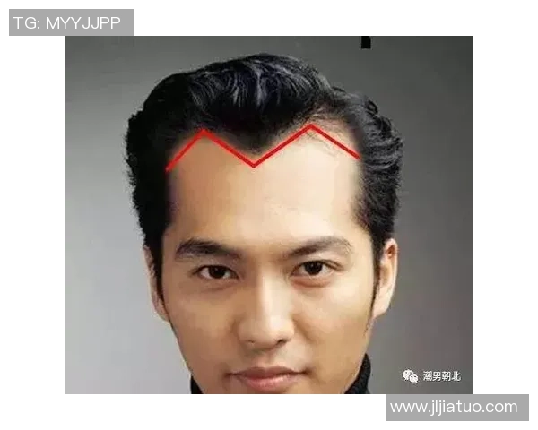 足球场上的M字发际线明星们如何逆袭成就辉煌人生 足球场上的M字发际线明星们如何逆袭成就辉煌人生